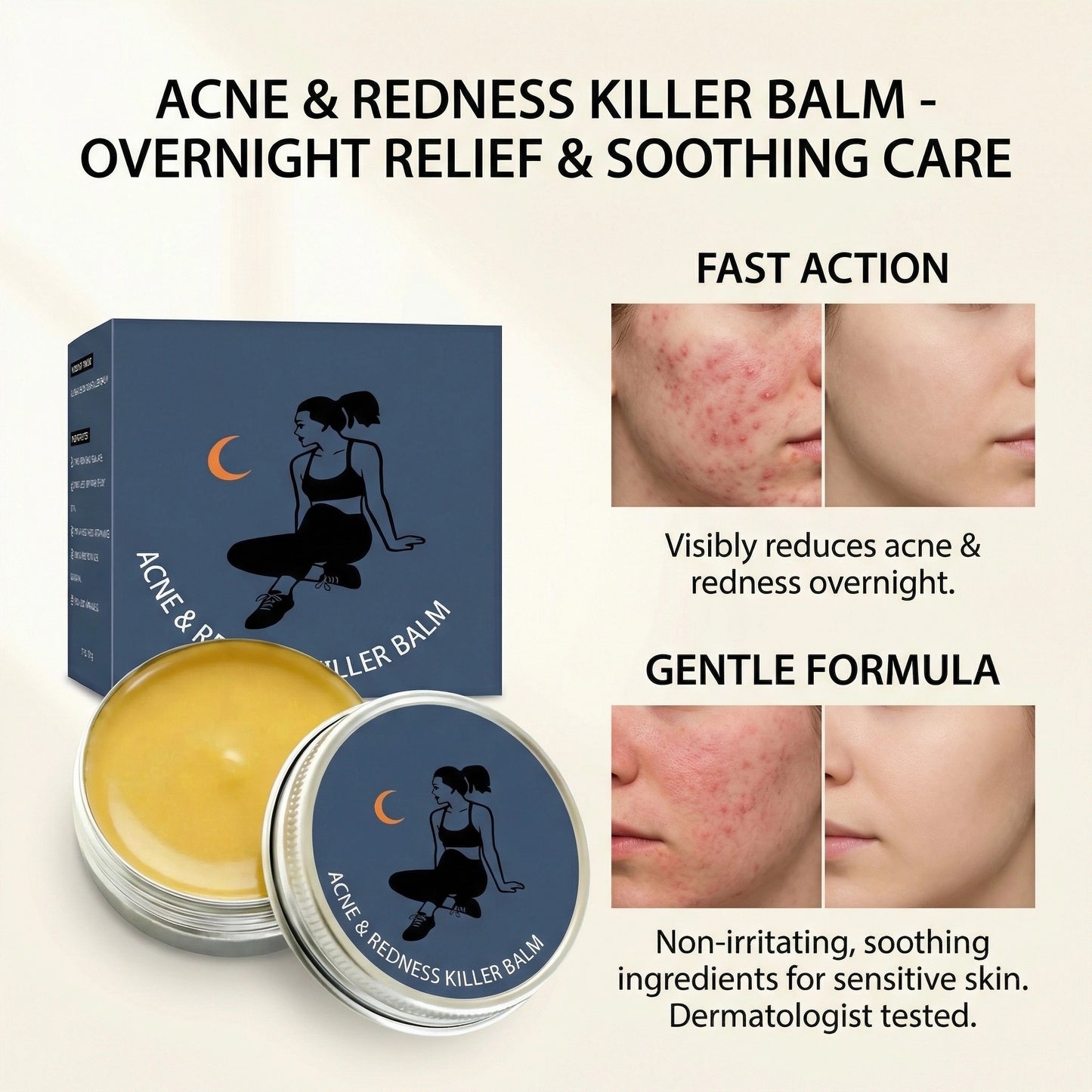 New-Gen Acne & Redness Killer Balm: Clearer Skin, Less Redness, Faster Recovery