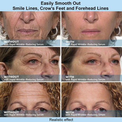 Alisanda™ Instant Face Temporary Tightener – Instant visible results in 60 seconds