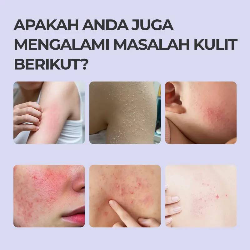 Nexisify® Skin-Soothing Gel, Skin-Conditioning Gel – Care for Your Skin