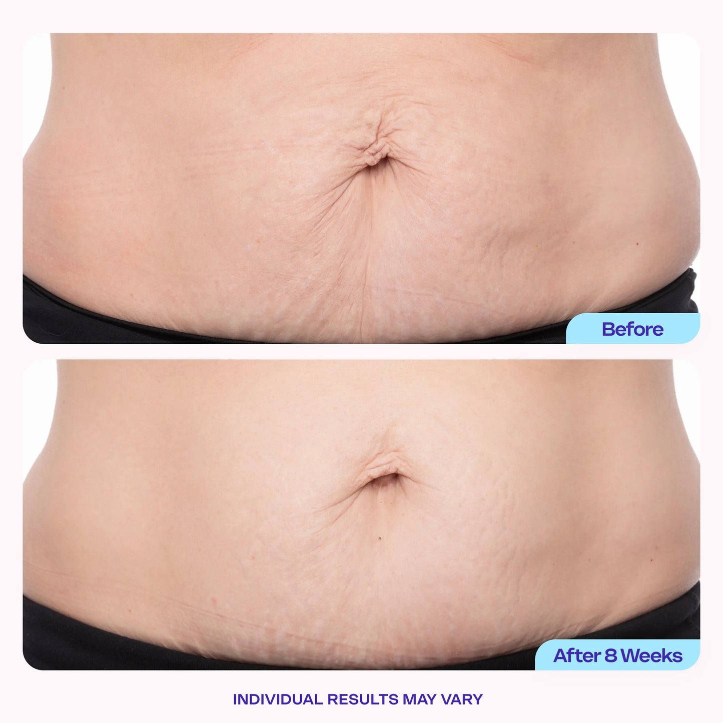 Cougex Tighten & Smooth Belly Firming Cream