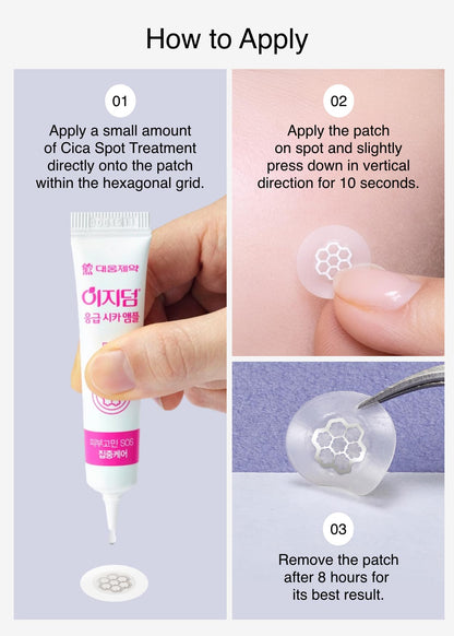 MOONBIFFY Quick Calming Magnesium Pimple Patches – Acne Spot Treatment with Tweezers & Ampoule