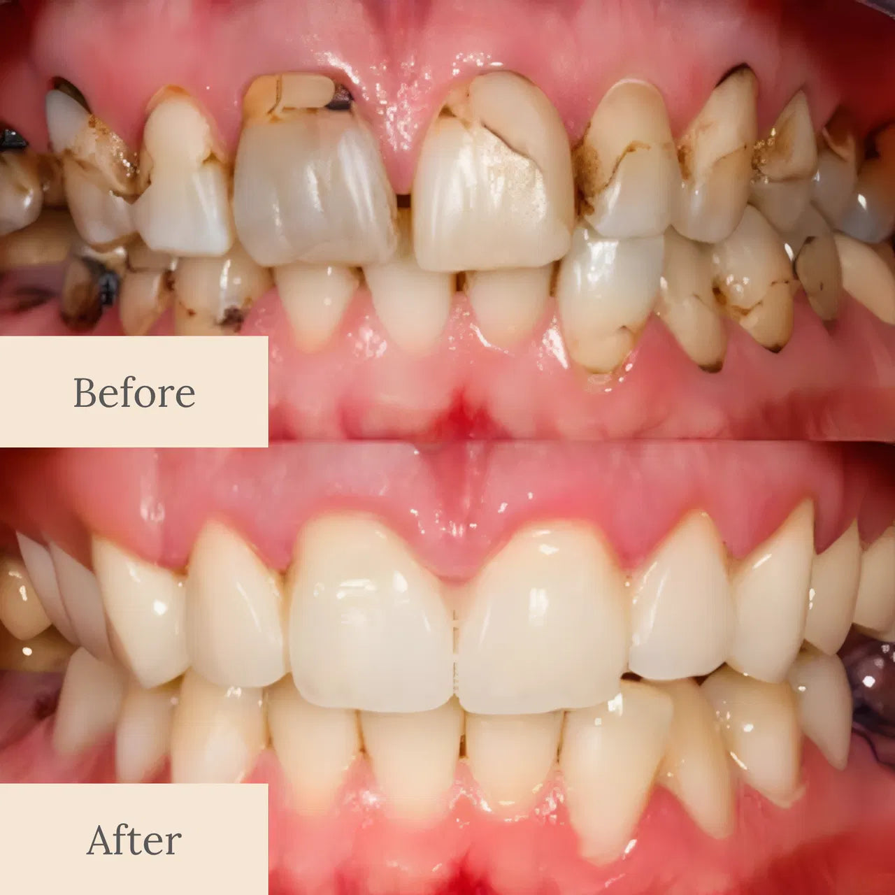 LOVILDS™ Advanced Enamel Support Drops