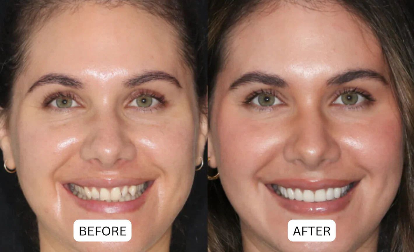 LOVILDS™ Advanced Enamel Support Drops