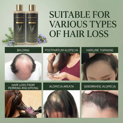 Alisanda® Rosemary Shampoo – Now Upgraded for Superior Hair Growth!