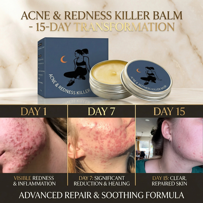 New-Gen Acne & Redness Killer Balm: Clearer Skin, Less Redness, Faster Recovery