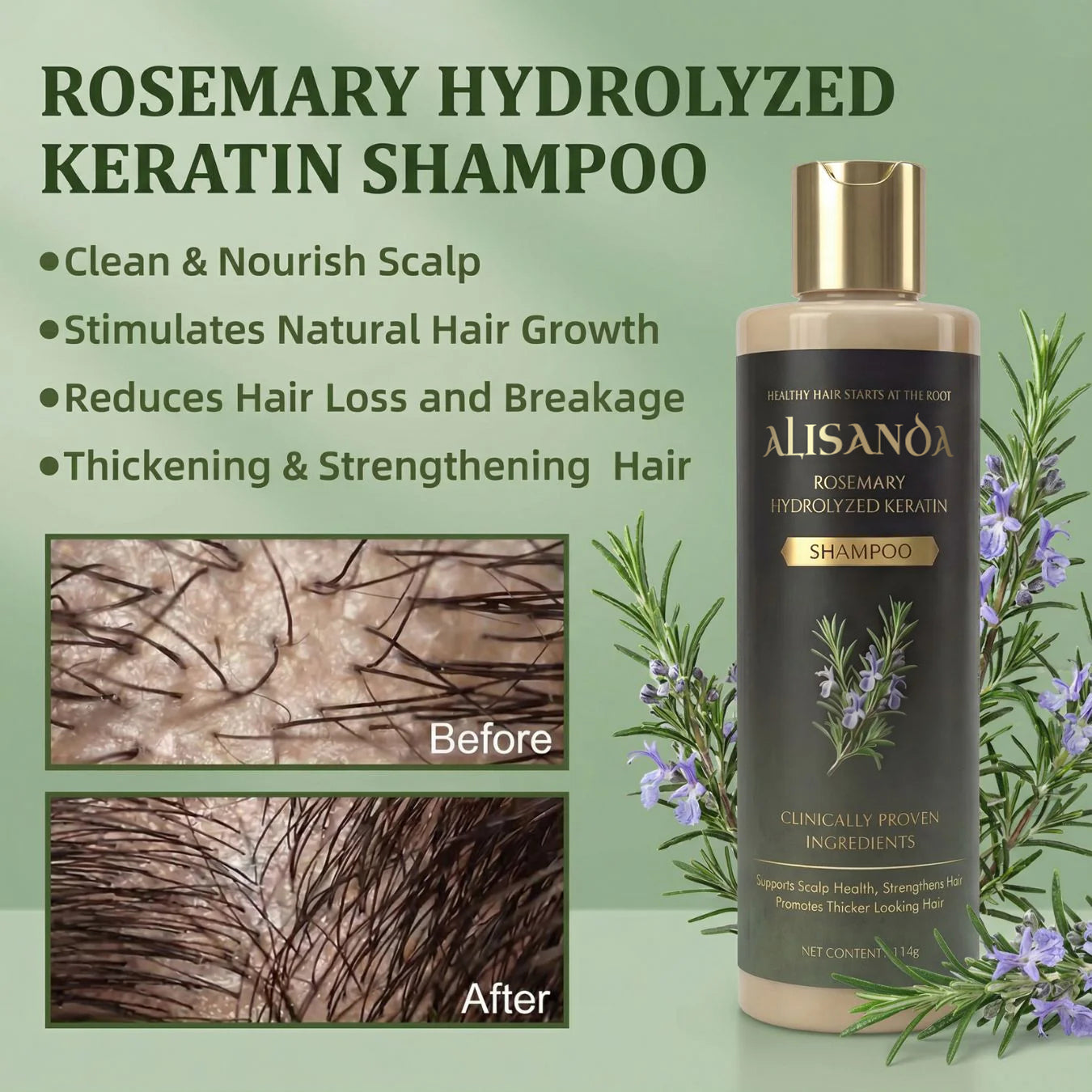 Alisanda® Rosemary Shampoo – Now Upgraded for Superior Hair Growth!