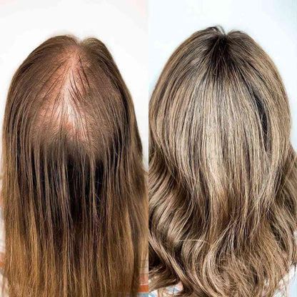 Slimoly® Premium Hair Serum – Premium Daily Care to Beautify Your Hair & Hairline Regular price