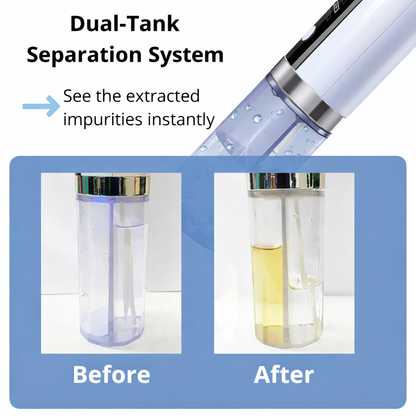 Dual-Tank Pore Cleansing Device - Visible pore cleansing with gentle vacuum suction