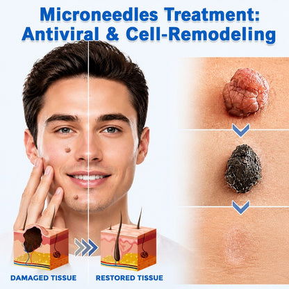 🌟 Cheemex® 2-in-1 Microneedle & Hydrocolloid Patch 🌿 Invisible Face & Body Patches for Raised Moles, Acne, Flat Warts & Skin Tags - Helps Improve the Appearance of Wrinkles, Scars & Blemishes