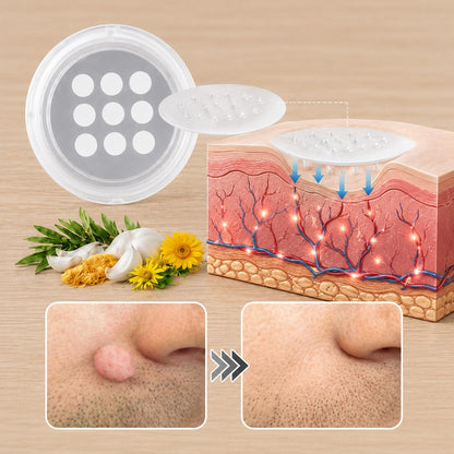🌟 Cheemex® 2-in-1 Microneedle & Hydrocolloid Patch 🌿 Invisible Face & Body Patches for Raised Moles, Acne, Flat Warts & Skin Tags - Helps Improve the Appearance of Wrinkles, Scars & Blemishes
