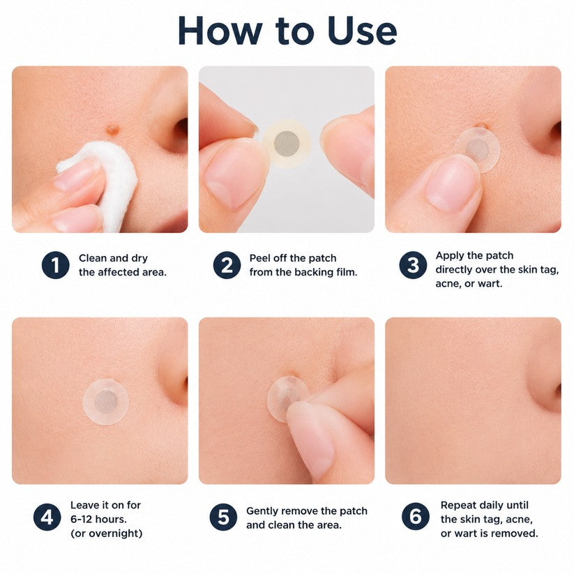 🌟 Cheemex® 2-in-1 Microneedle & Hydrocolloid Patch 🌿 Invisible Face & Body Patches for Raised Moles, Acne, Flat Warts & Skin Tags - Helps Improve the Appearance of Wrinkles, Scars & Blemishes