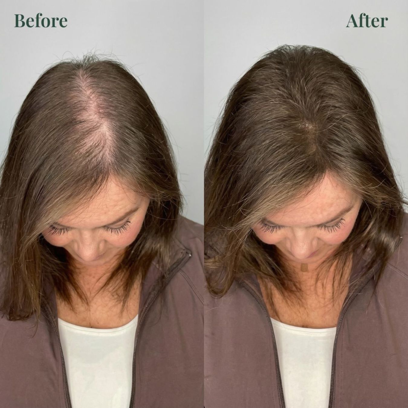 Alisanda® Rosemary Shampoo – Now Upgraded for Superior Hair Growth!