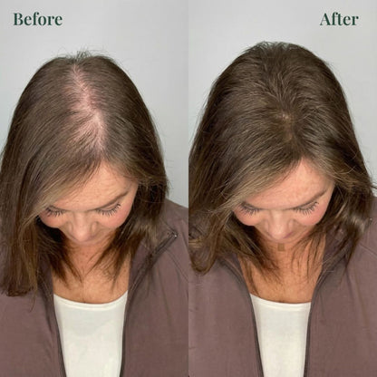 Alisanda® Rosemary Shampoo – Now Upgraded for Superior Hair Growth!
