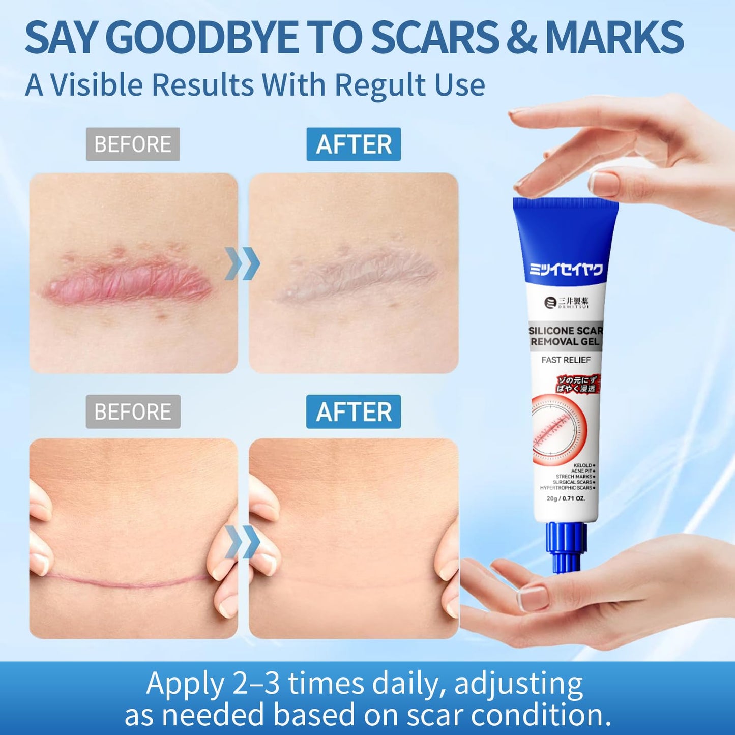 🌿Alisanda Scar Repair Cream|Treats Old and New Scars, Burns and More
