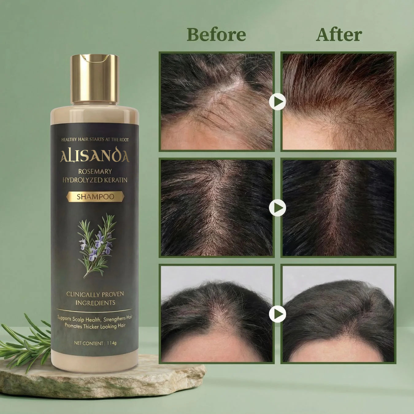 Alisanda® Rosemary Shampoo – Now Upgraded for Superior Hair Growth!