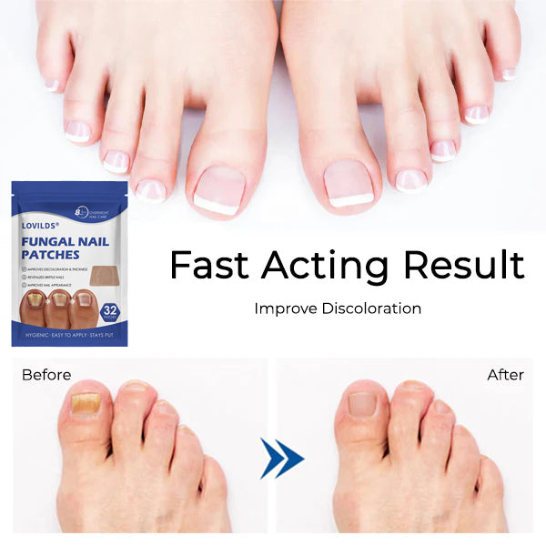 LOVILDS® FUNGAL NAIL PATCHES