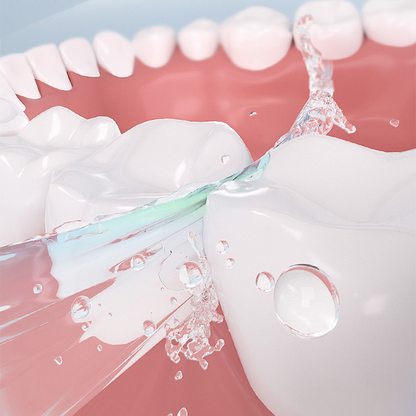 Vaxflite® UltraBond Premium Denture Adhesive 🔥 FDA Certified (Clinically Proven 4-Day Hold for Secure, Comfortable & Zinc-Free Denture Fit 🦷)