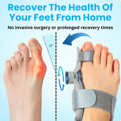 Cougex Pro - Non-Surgical Relief for Bunion Pain